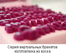 восковые модели брекетов восковые модели брекетов