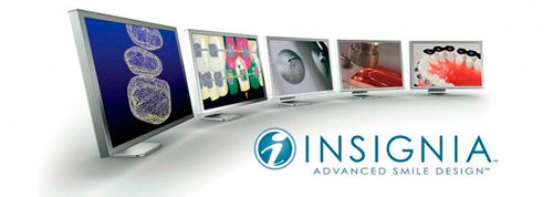брекеты Insignia брекеты Insignia